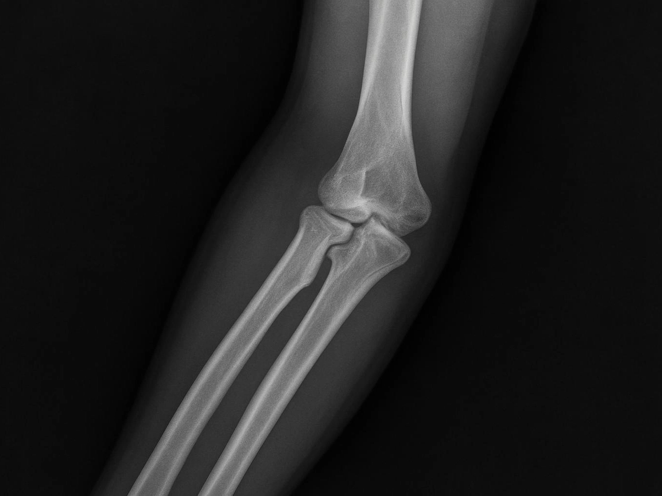 Atlanta Auto Law step-by-step service process — professional quality from start to finish